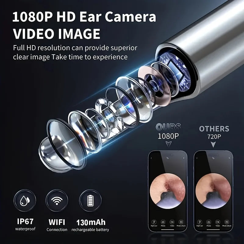 Smart Visual Ear Cleaner with 1296P Otoscope and USB-C Charging, Mini Camera Ear Wax Removal Tool and Health Care Set